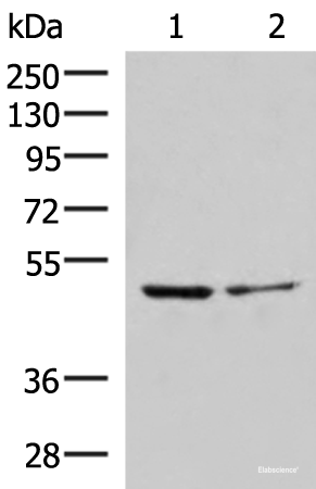 Western blot analysis of Jurkat and HepG2 cell lysates using ECSIT Polyclonal Antibody at dilution of 1:1000