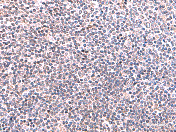 Immunohistochemistry of paraffin-embedded Human tonsil tissue using KIR3DL1 Polyclonal Antibody at dilution of 1:95(×200)