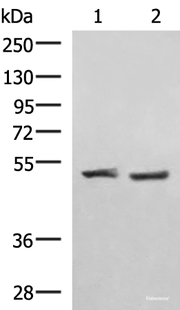 Western blot analysis of Human cerebella tissue K562 cell lysates using RRP8 Polyclonal Antibody at dilution of 1:1000