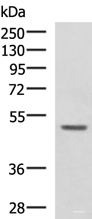 Western blot analysis of 293T cell lysate using GALK2 Polyclonal Antibody at dilution of 1:1350