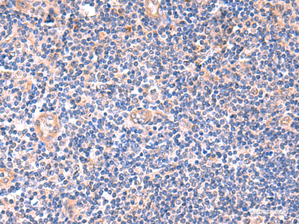 Immunohistochemistry of paraffin-embedded Human tonsil tissue using ZNF256 Polyclonal Antibody at dilution of 1:120(×200)
