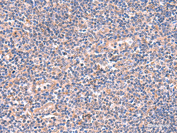 Immunohistochemistry of paraffin-embedded Human tonsil tissue using OSBPL2 Polyclonal Antibody at dilution of 1:55(×200)