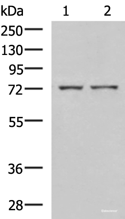 Western blot analysis of Mouse liver tissue and Jurkat cell lysates using ZAP70 Polyclonal Antibody at dilution of 1:800