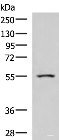 Western blot analysis of Human heart tissue lysate using ARIH2 Polyclonal Antibody at dilution of 1:1000