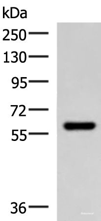 Western blot analysis of Mouse skeletal muscle tissue lysate using MYOT Polyclonal Antibody at dilution of 1:900