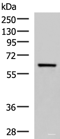 Western blot analysis of Human fetal brain tissue lysate using SARS Polyclonal Antibody at dilution of 1:850