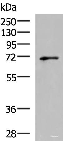 Western blot analysis of PC3 cell lysate using GSPT2 Polyclonal Antibody at dilution of 1:600