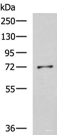 Western blot analysis of K562 cell lysate using GSTCD Polyclonal Antibody at dilution of 1:800