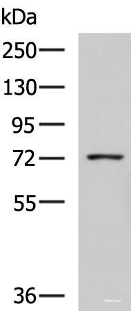 Western blot analysis of K562 cell lysate using GUSB Polyclonal Antibody at dilution of 1:800