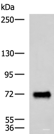 Western blot analysis of Human fetal brain tissue lysate using PPEF1 Polyclonal Antibody at dilution of 1:1500