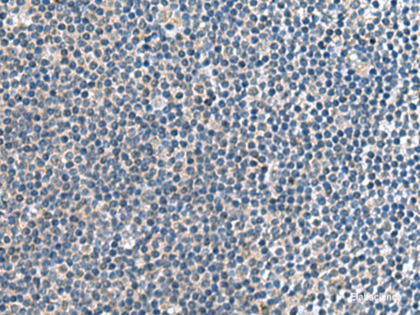 Immunohistochemistry of paraffin-embedded Human tonsil tissue using CNTN4 Polyclonal Antibody at dilution of 1:65(×200)