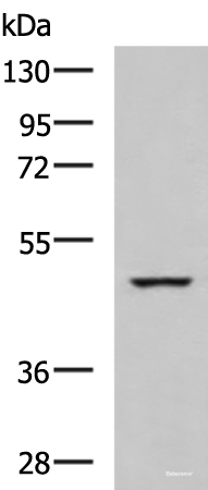 Western blot analysis of K562 cell lysate using IP6K2 Polyclonal Antibody at dilution of 1:650