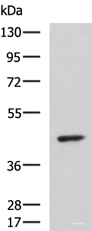 Western blot analysis of Hela cell lysate using ARPC1B Polyclonal Antibody at dilution of 1:1000