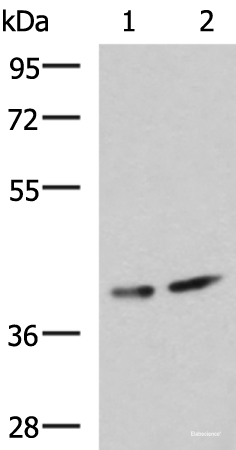 Western blot analysis of Human cerebrum tissue and Mouse brain tissue lysates using PROKR2 Polyclonal Antibody at dilution of 1:800