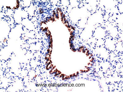 Immunohistochemistry of paraffin-embedded Mouse liver tissue using TGFB1 Monoclonal Antibody at dilution of 1:200.