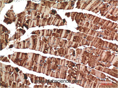 Immunohistochemistry of paraffin-embedded Mouse skeletal muscle tissue using ACTA1 Monoclonal Antibody at dilution of 1:200.