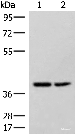 Western blot analysis of Hela and 231 cell lysates using HPDL Polyclonal Antibody at dilution of 1:400