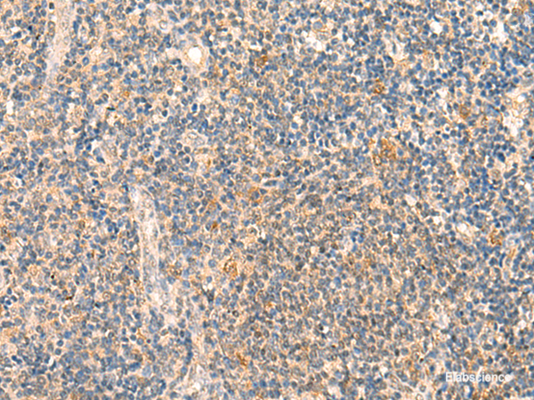 Immunohistochemistry of paraffin-embedded Human tonsil tissue using HSPA4L Polyclonal Antibody at dilution of 1:30(×200)