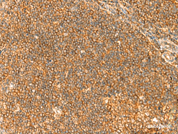 Immunohistochemistry of paraffin-embedded Human tonsil tissue using TBCK Polyclonal Antibody at dilution of 1:40(×200)