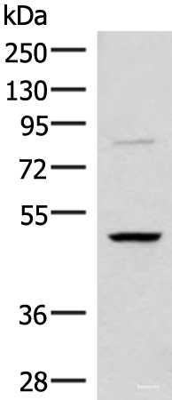 Western blot analysis of Human bladder transitional cell carcinoma grade 2-3 tissue lysate using RRP8 Polyclonal Antibody at dilution of 1:800