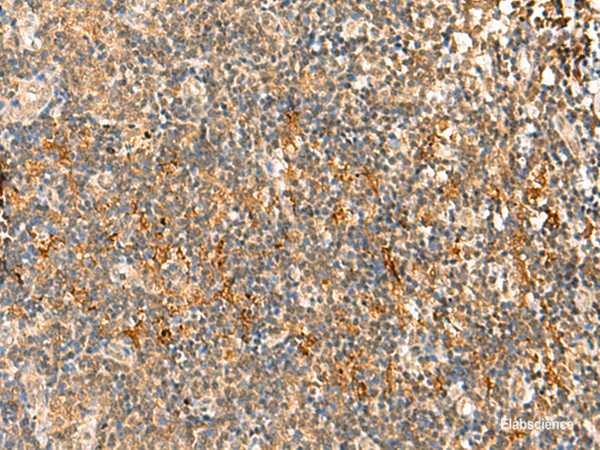 Immunohistochemistry of paraffin-embedded Human tonsil tissue using HTT Polyclonal Antibody at dilution of 1:30(×200)