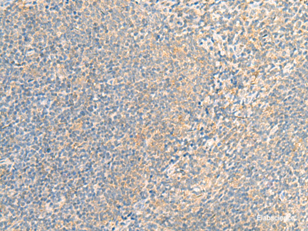 Immunohistochemistry of paraffin-embedded Human tonsil tissue using IFNA5 Polyclonal Antibody at dilution of 1:35(×200)