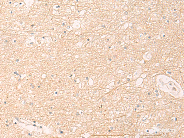 Immunohistochemistry of paraffin-embedded Human brain tissue using ELP1 Polyclonal Antibody at dilution of 1:30(×200)