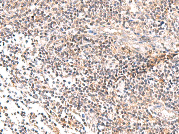 Immunohistochemistry of paraffin-embedded Human tonsil tissue using IL36B Polyclonal Antibody at dilution of 1:40(×200)
