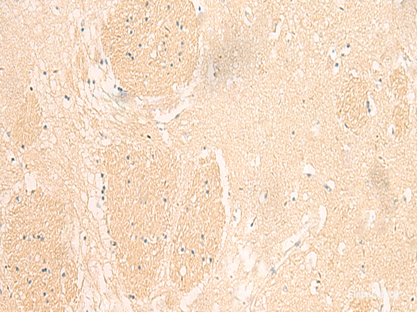 Immunohistochemistry of paraffin-embedded Human brain tissue using IL37 Polyclonal Antibody at dilution of 1:50(×200)