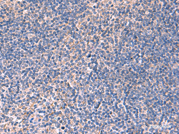 Immunohistochemistry of paraffin-embedded Human tonsil tissue using INPP5B Polyclonal Antibody at dilution of 1:40(×200)
