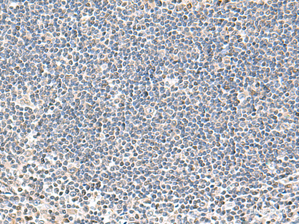 Immunohistochemistry of paraffin-embedded Human tonsil tissue using IFNA2 Polyclonal Antibody at dilution of 1:40(×200)