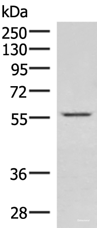 Western blot analysis of Jurkat cell lysate using IPPK Polyclonal Antibody at dilution of 1:550