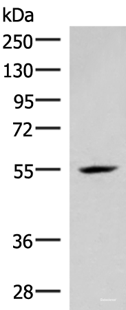 Western blot analysis of Mouse heart tissue lysate using IRX4 Polyclonal Antibody at dilution of 1:400