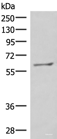 Western blot analysis of RAW264.7 cell lysate using MBTPS2 Polyclonal Antibody at dilution of 1:800