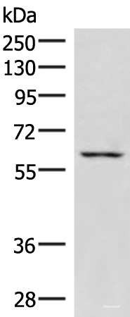 Western blot analysis of K562 cell lysate using JRKL Polyclonal Antibody at dilution of 1:1000