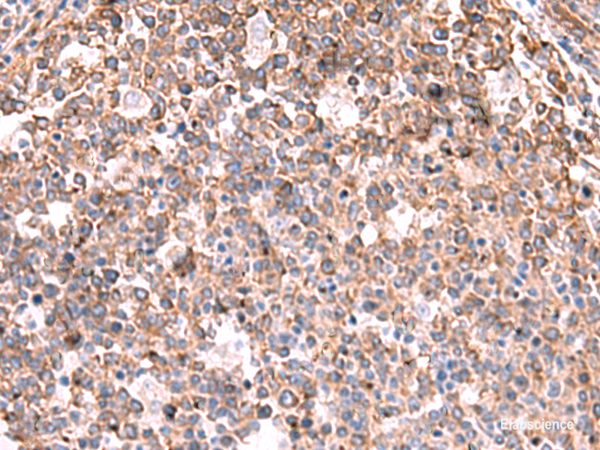 Immunohistochemistry of paraffin-embedded Human tonsil tissue using KBTBD11 Polyclonal Antibody at dilution of 1:35(×200)