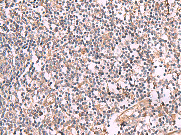 Immunohistochemistry of paraffin-embedded Human tonsil tissue using SLC12A5 Polyclonal Antibody at dilution of 1:50(×200)