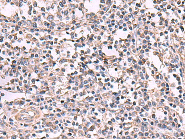 Immunohistochemistry of paraffin-embedded Human tonsil tissue using KCNK18 Polyclonal Antibody at dilution of 1:80(×200)