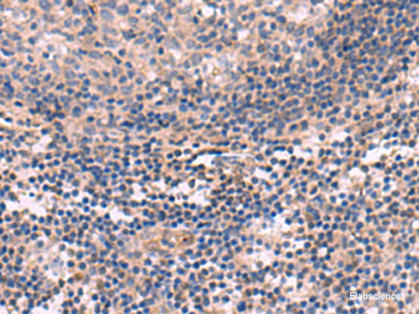 Immunohistochemistry of paraffin-embedded Human tonsil tissue using KCNT1 Polyclonal Antibody at dilution of 1:30(×200)