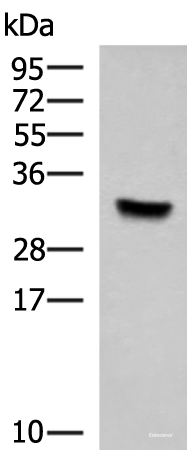 Western blot analysis of Hela cell lysate using KCTD7 Polyclonal Antibody at dilution of 1:1000