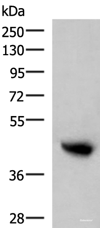 Western blot analysis of Human plasma solution using KIR2DL5A Polyclonal Antibody at dilution of 1:800