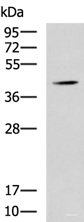 Western blot analysis of Mouse liver tissue lysate using SPI1 Polyclonal Antibody at dilution of 1:1600