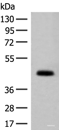 Western blot analysis of Mouse small intestines tissue lysate using GPA33 Polyclonal Antibody at dilution of 1:200
