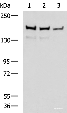 Western blot analysis of Mouse brain tissue Rat brain tissue and HepG2 cell lysates using ROCK2 Polyclonal Antibody at dilution of 1:400