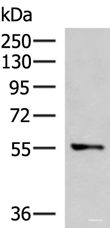 Western blot analysis of A172 cell lysate using TEKT5 Polyclonal Antibody at dilution of 1:800
