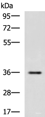 Western blot analysis of Human fetal liver tissue lysate using IBSP Polyclonal Antibody at dilution of 1:650