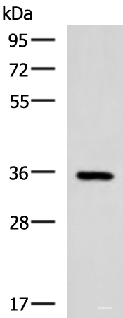 Western blot analysis of Mouse brain tissue lysate using B3GAT1 Polyclonal Antibody at dilution of 1:650