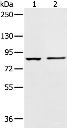 Western blot analysis of 293T cell and Human left kidney tissue using AAK1 Polyclonal Antibody at dilution of 1:400