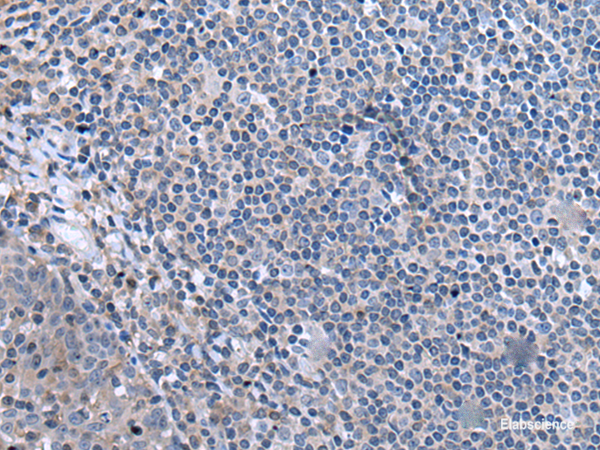 Immunohistochemistry of paraffin-embedded Human tonsil tissue using CCK Polyclonal Antibody at dilution of 1:55. (Original magnific at ion: ×200) at dilution of 1:55(×200)