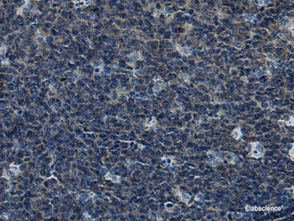 Immunohistochemistry of paraffin-embedded Human tonsil tissue using CUL5 Polyclonal Antibody at dilution of 1:55(×200)
